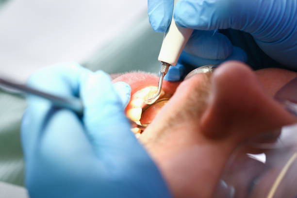 Best Emergency Dental Extractions in Mcconnellstown, PA